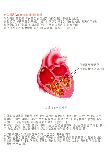 1.부정맥과 이식형제세동기