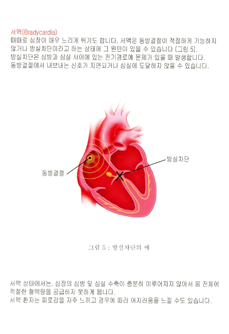 1.부정맥과 이식형제세동기